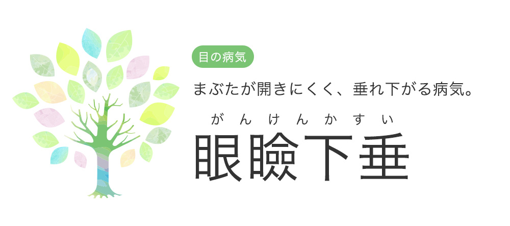 まぶたが開きにくく垂れ下がる病気 眼瞼下垂 中央眼科グループ